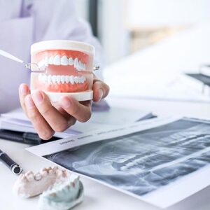 Model Teeth